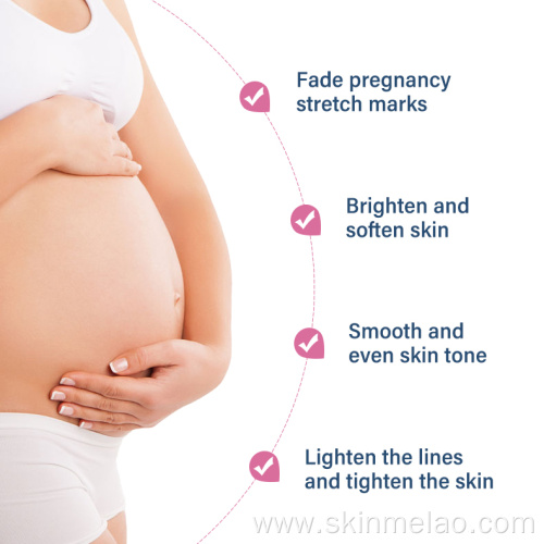 Pregnancy Removal Scars Prevention Stretch Cream Stick